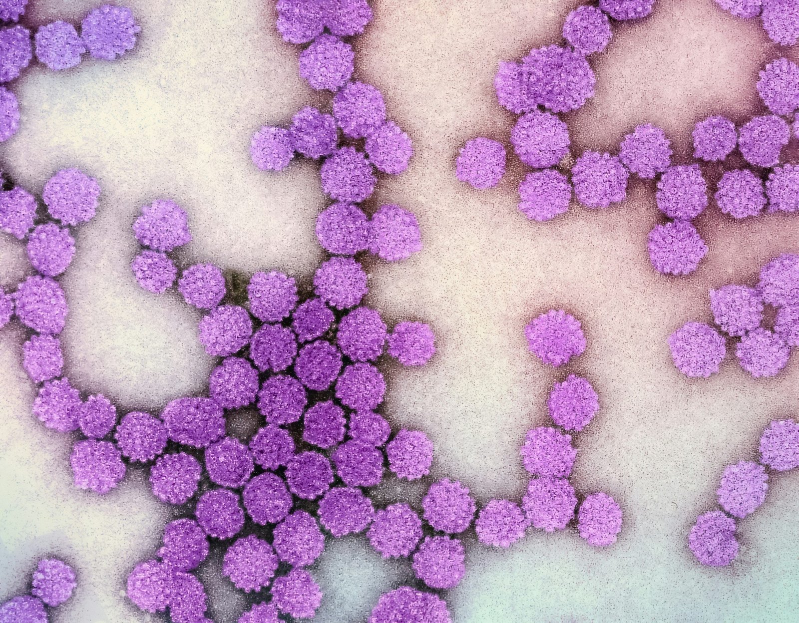 a close up of a bunch of purple balls